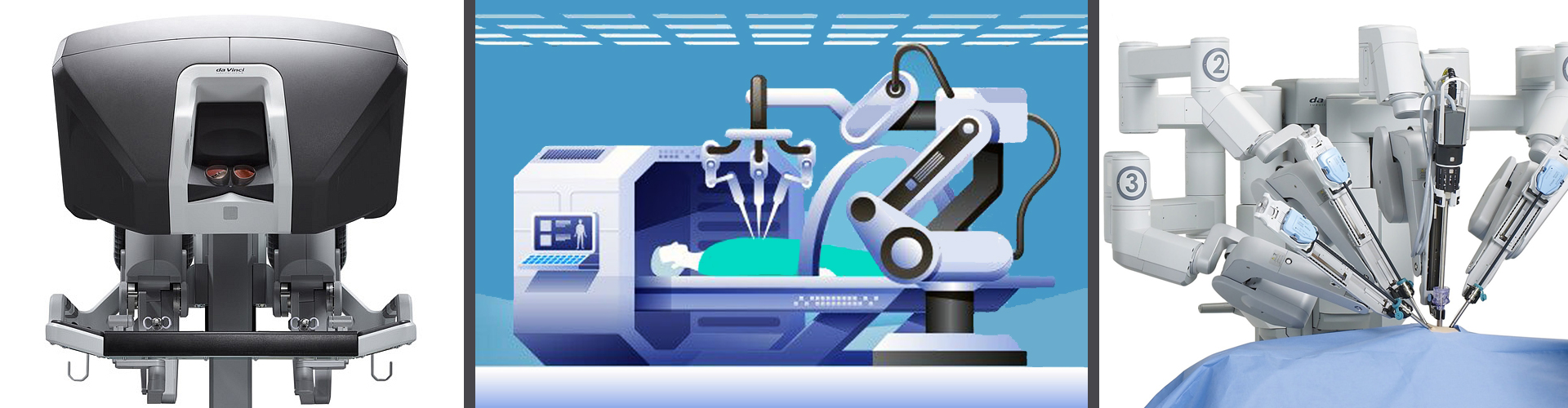 La Chirurgia Robotica in Urologia